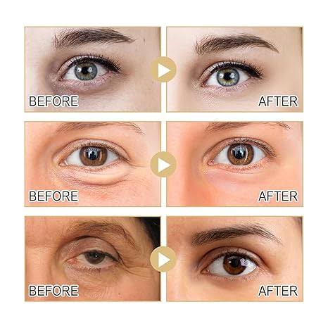 HOYGI Instant firm Eye