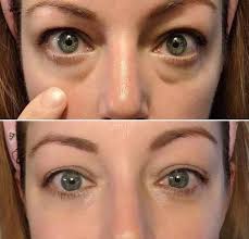 HOYGI Instant firm Eye